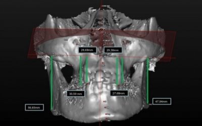 18-cirugia-de-las-deformidades-faciales-xl