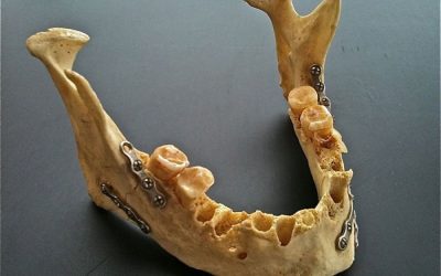 19-traumatologia-facial-xl