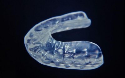 que-es-una-ferula-de-relajacion