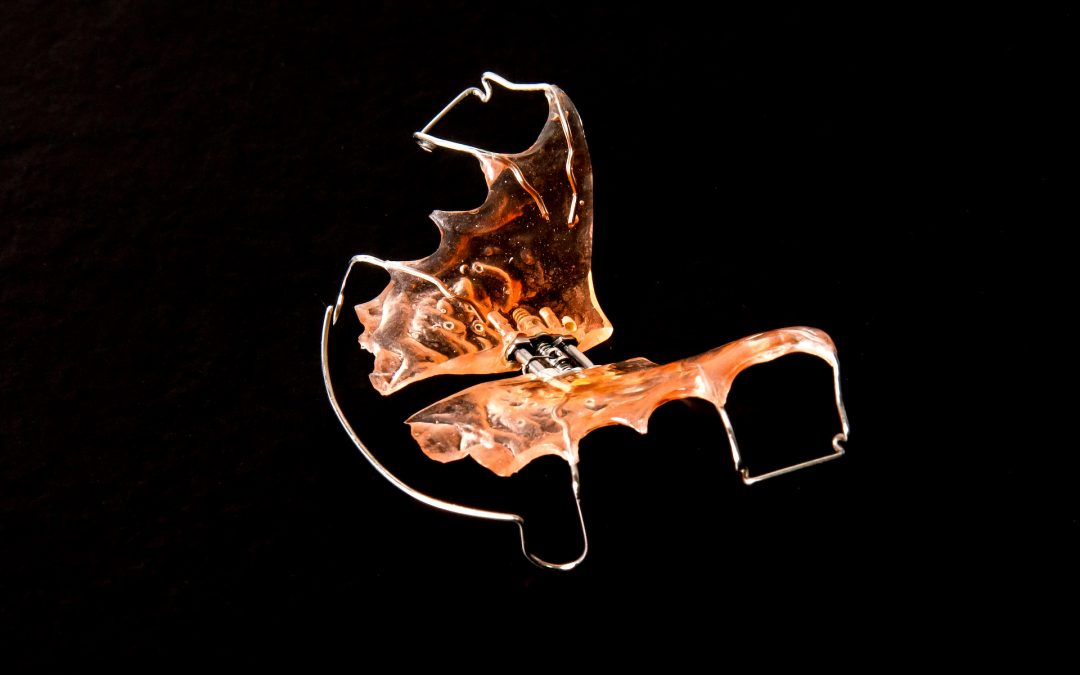 ¿A qué edad se debe comenzar un tratamiento de ortodoncia?